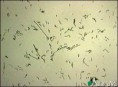 Campylobacter
